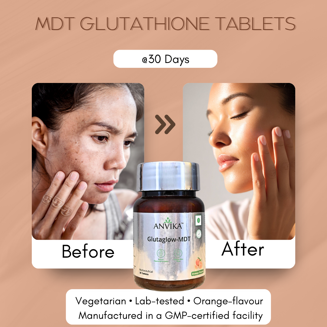 ANVIKA Glutaglow-MDT Glutathione Tablets – Skin Brightening, Antioxidant, Orange Flavor (30 Tablets)