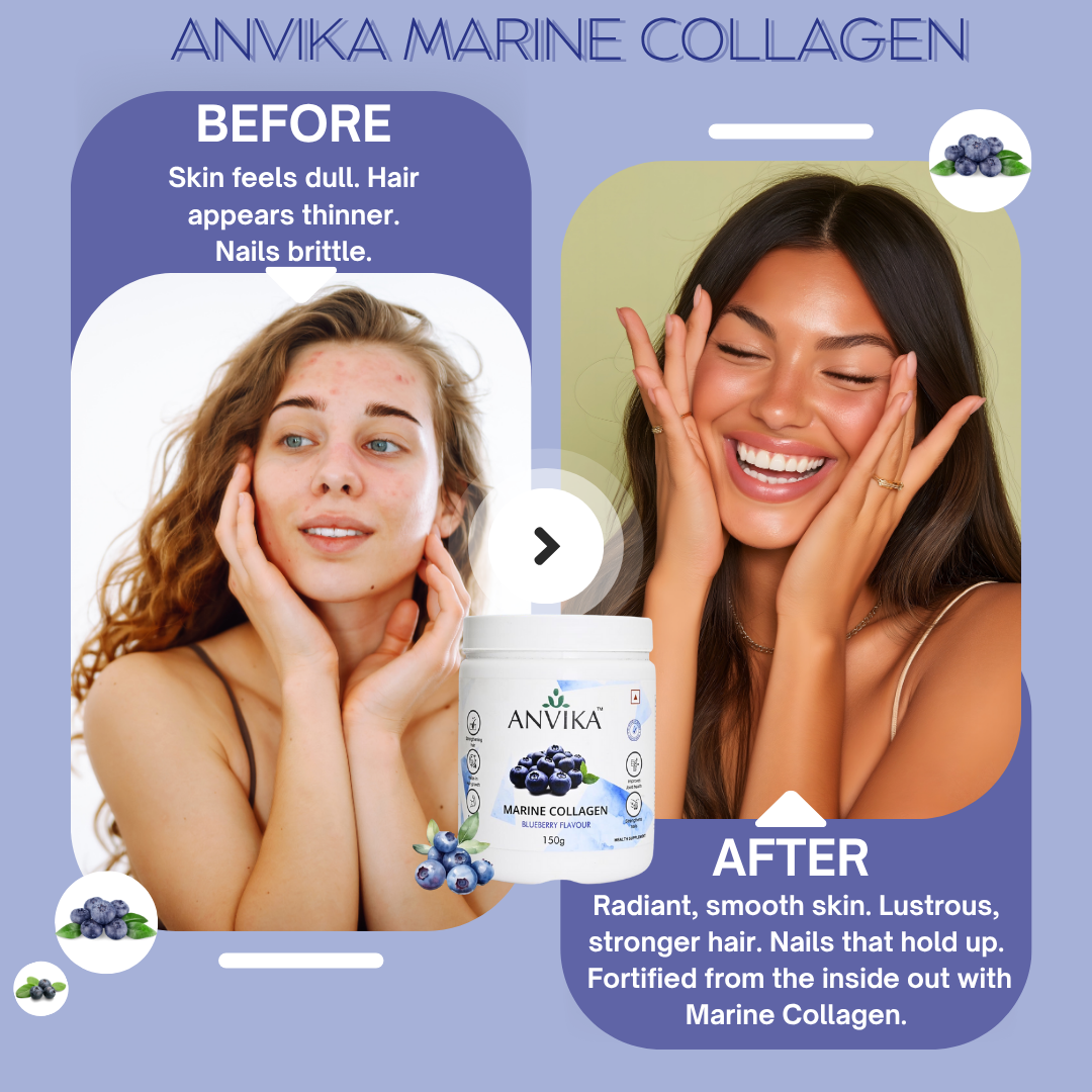 ANVIKA Marine Collagen Powder – Blueberry Flavor, Supports Skin, Hair, Nails & Joints – 150 g
