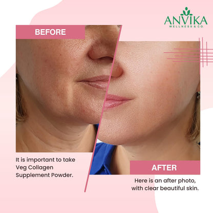 Anvika Veg Collagen | Strawberry Flavour | Skin & Hair Support | 150g